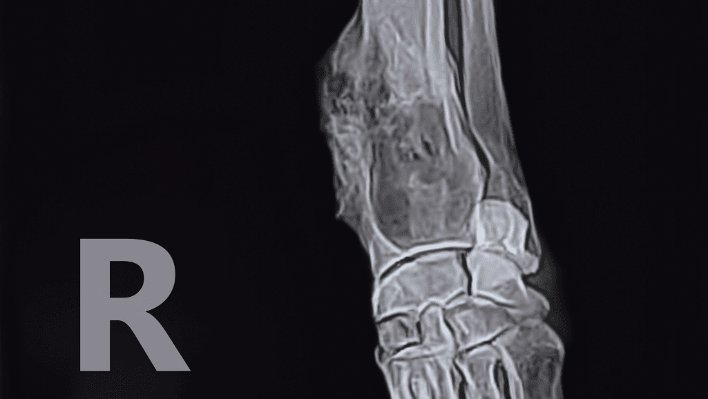 Canine-Osteosarcoma